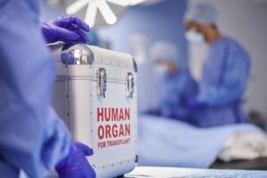 Centre asks hospitals to disclose post-organ transplant survival data