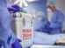 Centre asks hospitals to disclose post-organ transplant survival data