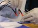 Beyond pills and surgery: how radiofrequency ablation is helping chronic pain sufferers