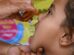 Telangana gears up for Pulse Polio drive on June 28, targeting 40.97 lakh children